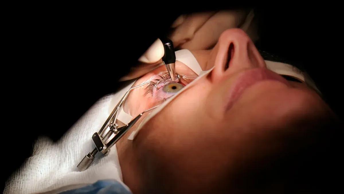 تقنية مبتكرة لتصحيح الرؤية دون جراحة