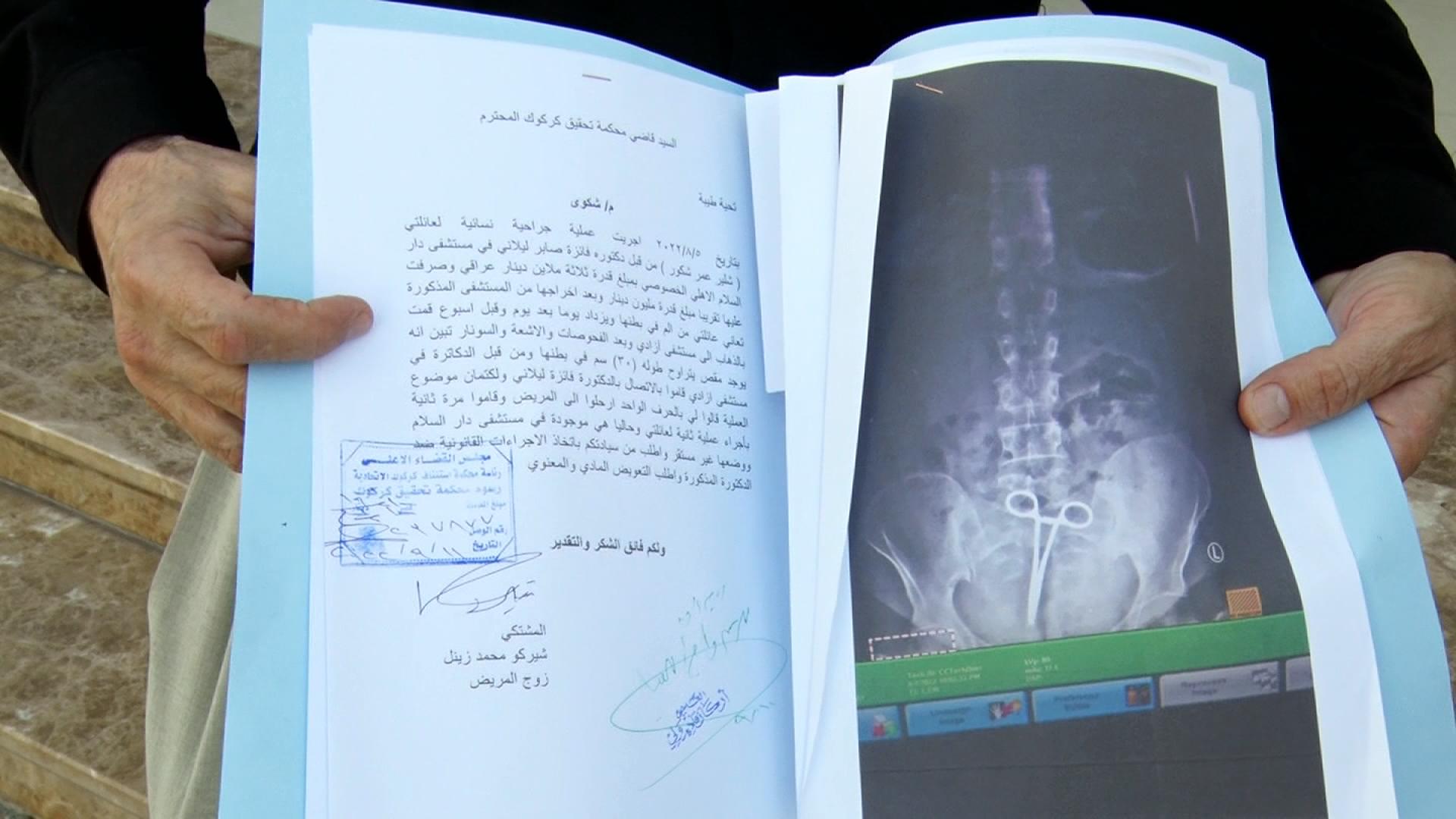 پزیشکێک لە سکی نەخۆشێکدا مقەستێک بەجێدەهێڵێت