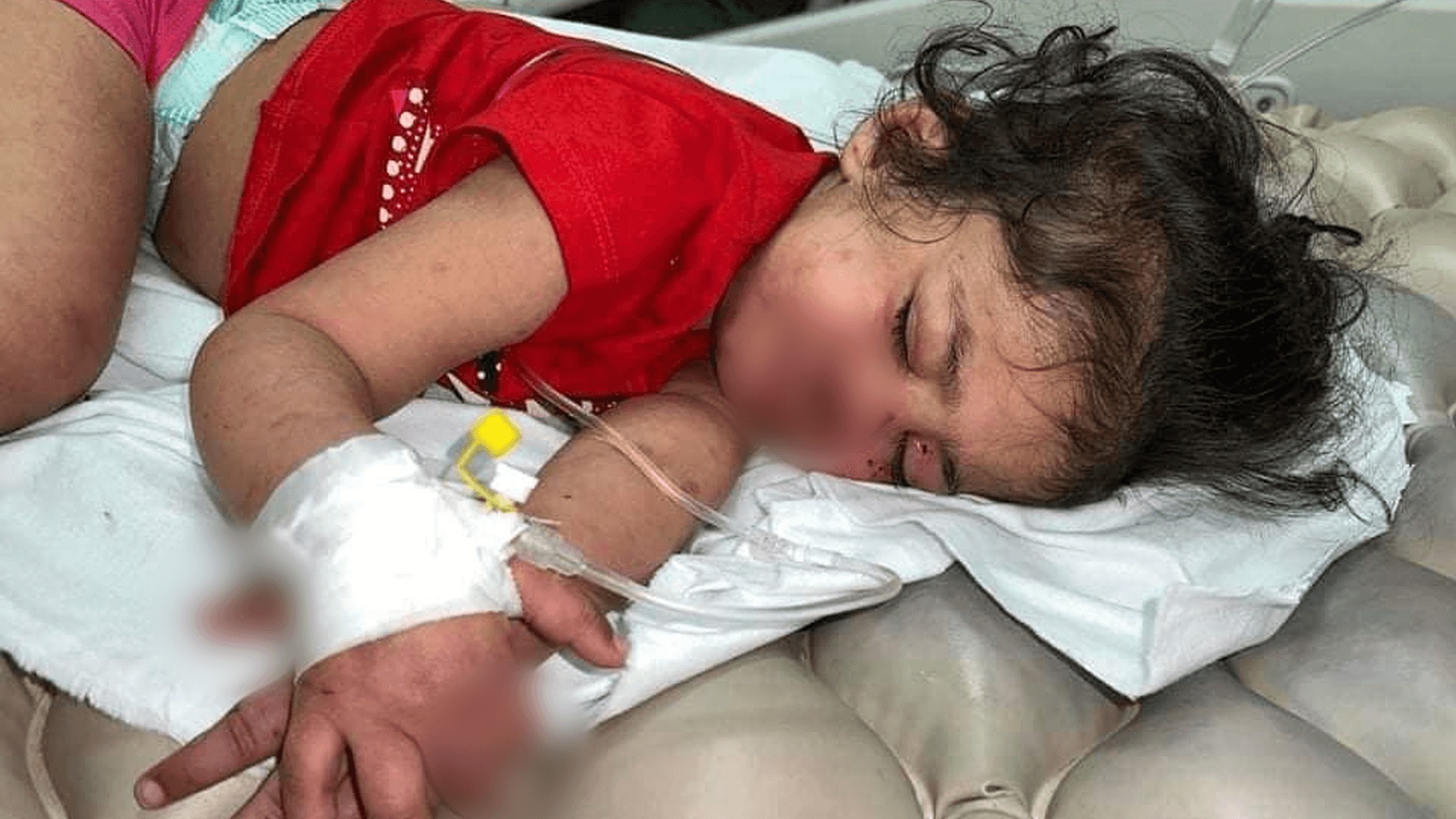 منداڵێک لە کەرکووک بە توندی لەلایەن باوەژنەکەی ئەشکەنجە دەدرێت