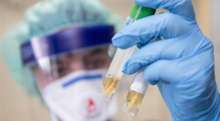 تەندروستی جیهانی هۆشداری لە سەرھەڵدانی نەخۆشییەک دەدات کە زۆر لە کۆرۆنا مەترسیدارترە