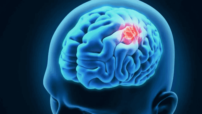 دراسة: ضبط معدلات ضغط الدم يحمي من الخرف