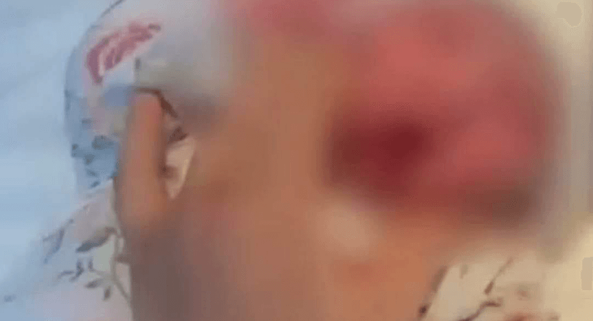 وەزارەتی تەندروستی چەند بڕیارێکی لەبارەی ئازاردانی منداڵە تازە لەدایکبووەکەوەدا 