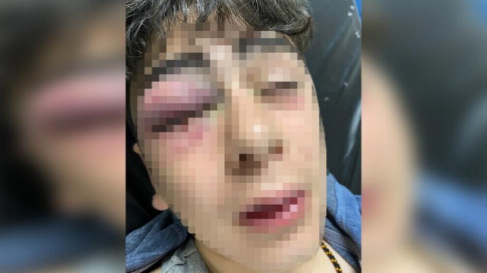 لە ئامەد پۆلیس مێردمنداڵێکی کورد بەتوندی ئەشکەنجە دەدات