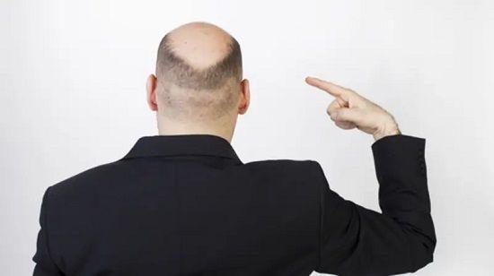 دراسة: النساء يجدن الرجال الصلع أكثر جاذبية