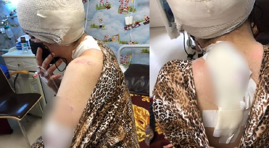 ژنێک لە سلێمانی لەلایەن مێردەکەیەوە ١٥ چەقۆی لێدرا