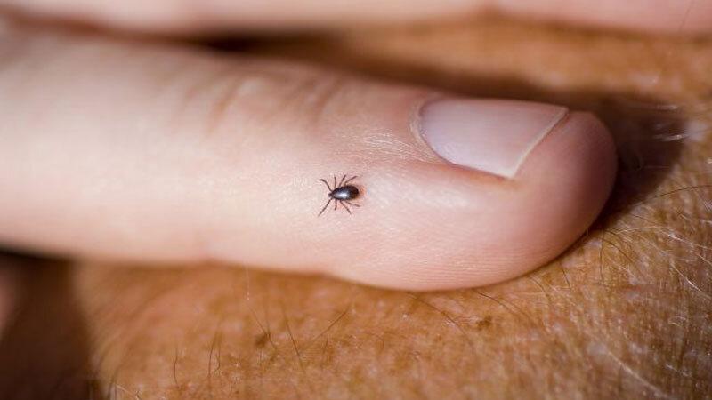 First case of Congo fever recorded in Akre