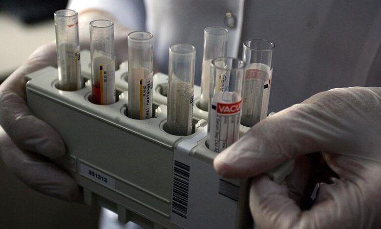 الصحة تعلق على إصابات الايدز في العراق: الاصابات محدودة جداً مقارنة بعدد السكان