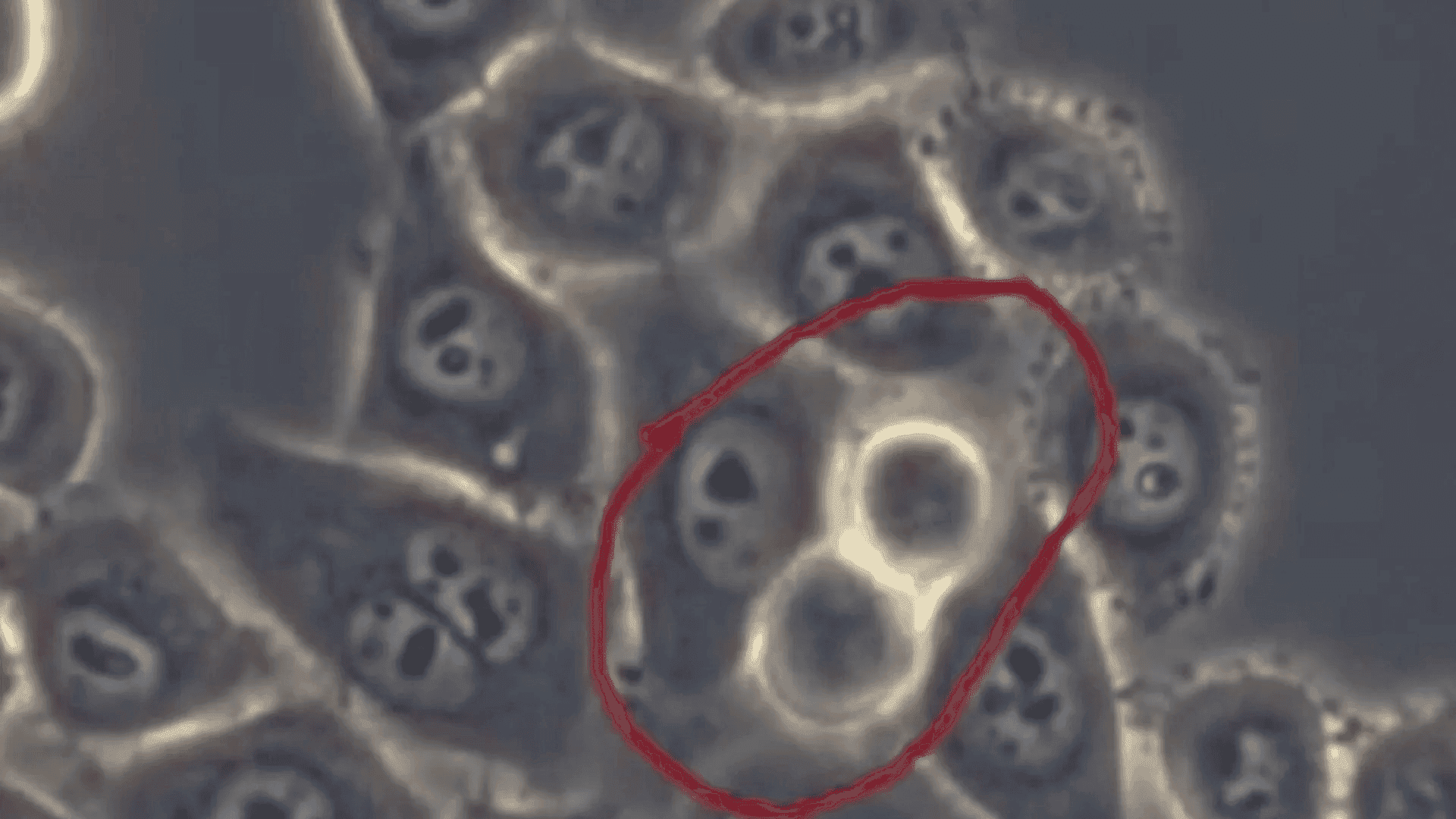 زیرەکی دەستکرد لە پزیشکەکان زیرەکتر دەرچو