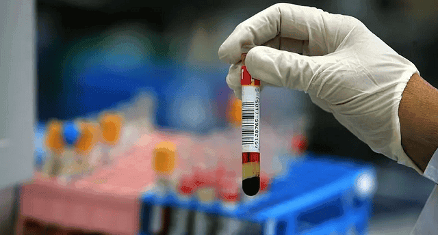 قبل الصيام.. 5 فحوصات ضرورية عليك إجراؤها