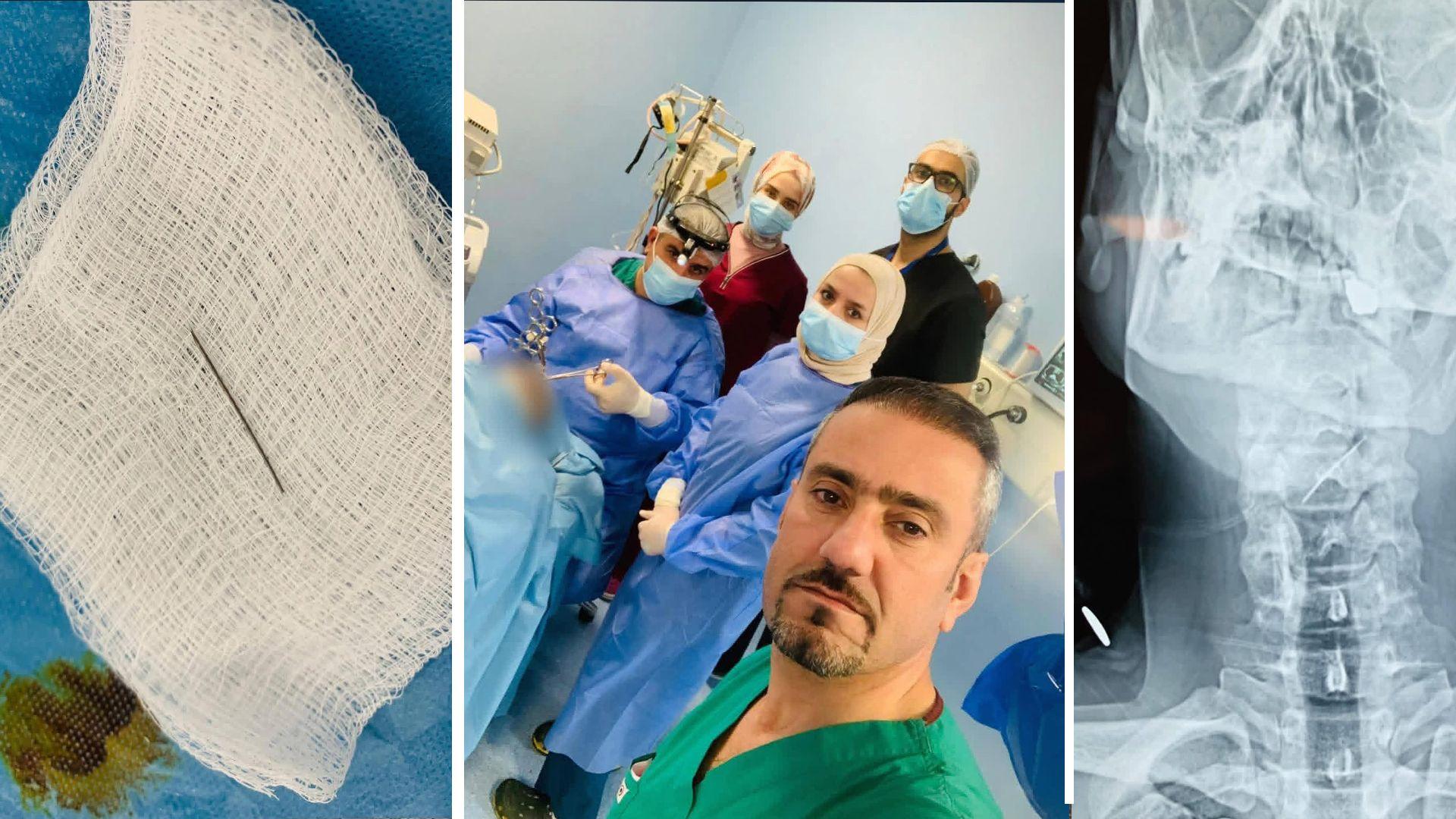 لە سلێمانی نەشتەرگەرییەکی هەستیار ئەنجامدرا