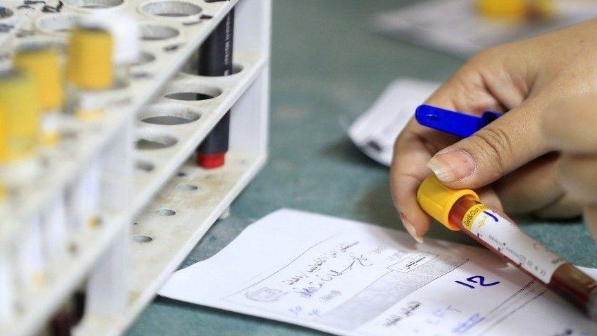 الأمانة العامة تلزم الوزارات باعتماد الفحص الطبي وإثبات عدم تعاطي المخدرات عند التعيين